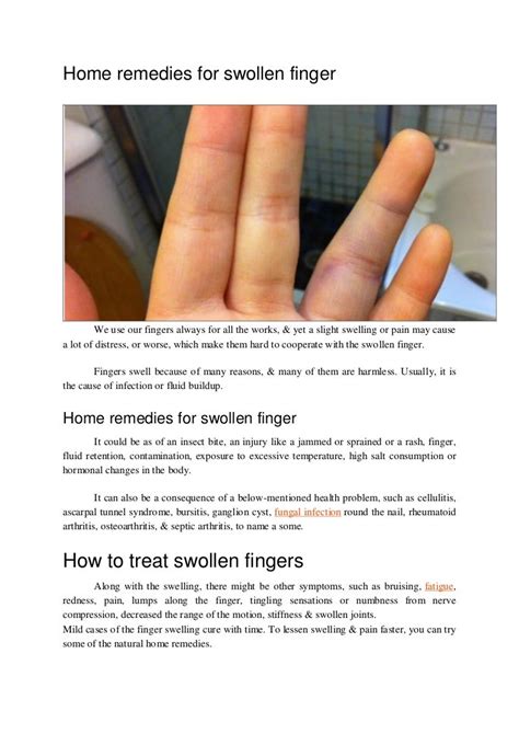 Home Remedies For Swollen Finger