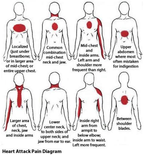 10 Of The Most Common Signs 30 Days Before A Heart Attack Health