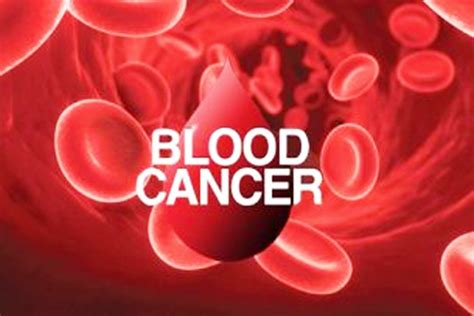 Explanations about what cancer is, how cancer cells differ from normal cells, and genetic changes that cause cancer to grow and spread. Blood Cancer - Rising Cases of Lymphoma, Leukemia ...