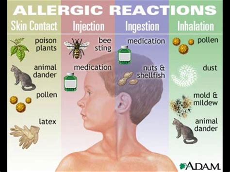 How To Get Rid Of Allergies Without Taking Medicine Top Home Remedies