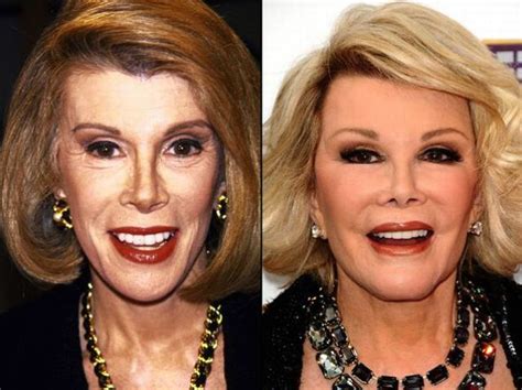 We provide high level of safety and plastic surgery care. Celebrities Before and After a Plastic Surgery (21 pics)