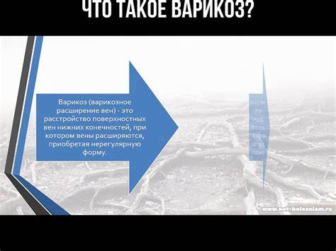 Что такое варикоз? – Видео Dailymotion Картинка - Что такое варикоз? – Видео Dailymotion