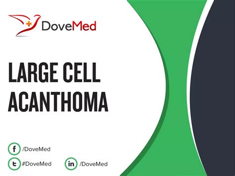 Large Cell Acanthoma Dovemed