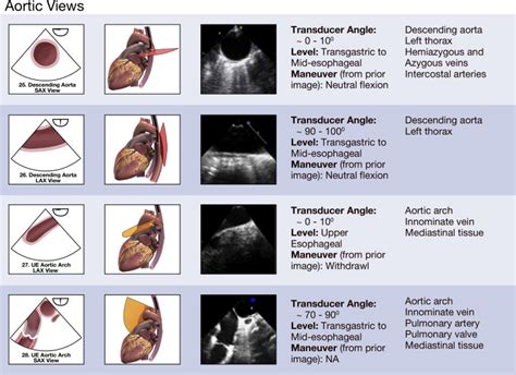Comprehensive Transesophageal Echocardiographic Examination Grepmed