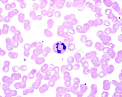 Human Blood Smear Neutrophil Stock Photo Image Of Haematology