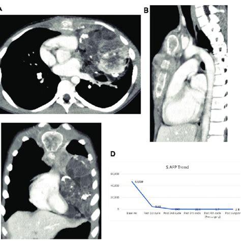 A C Contrast Enhanced Computed Tomography Cect Scan Showing The