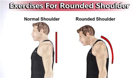 5 Best Exercises To Correct Rounded Shoulders Youtube