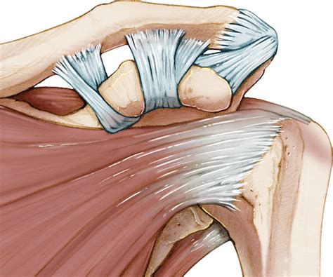 Acromioclavicular Joint Injury
