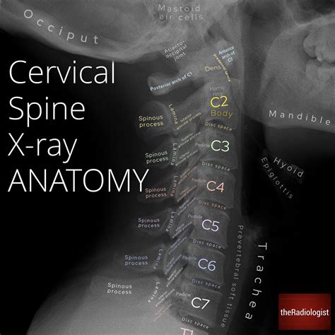 Cervical Spine X Ray Anatomy By Dr Naveen Sharma Grepmed The Best