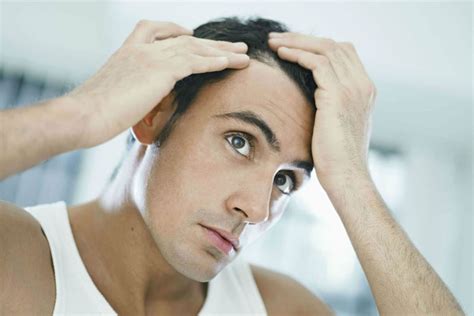 It is a disorder that can be caused by many different factors. How To Stop A Receding Hairline and Regrow Hair (2020 Guide)