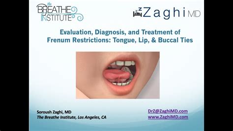 Full Lecture Evaluation Diagnosis And Treatment Of Tongue Lip