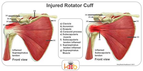 Tendons to attach the muscles to the bones. Front Shoulder Muscles Diagram / Shoulder Anatomy ...