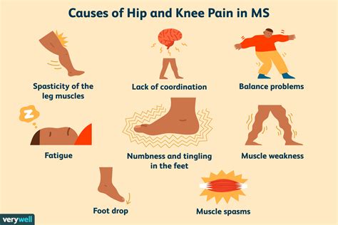 What Causes Hip And Leg Pain Cares Healthy