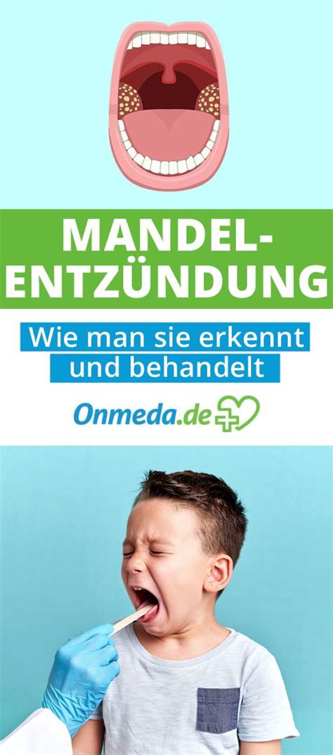 Mandelentzündung Das Sind Die Typischen Symptome Angina Health Diet