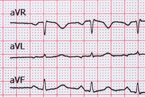 Function Of The Heart Bodytomy