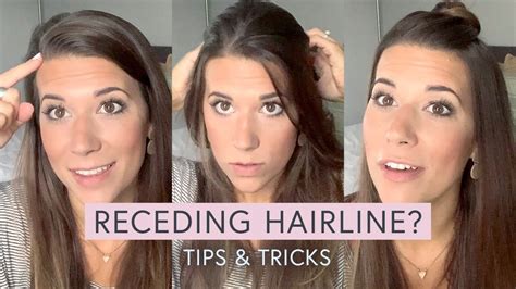 Receding Hairline Tips Tricks Youtube