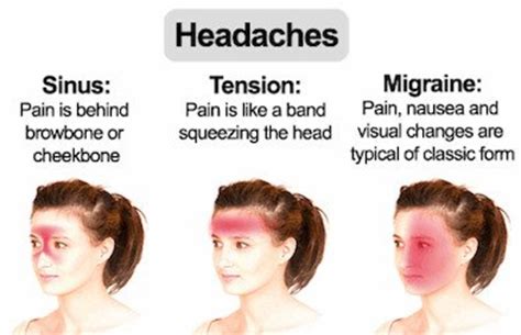Headache In Back Of Head Location Causes And Treatment Hubpages