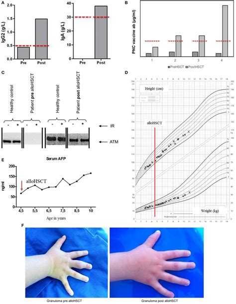 Voriconazole and sirolimus coadministration after allogeneic hematopoietic stem cell transplantation. | After allogeneic hematopoietic stem cell transplantation ...