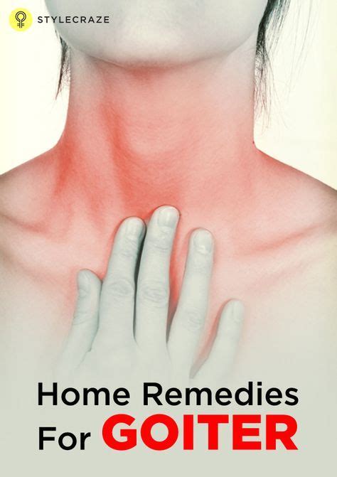 17 Effective Home Remedies For Goiter Natural Headache Remedies