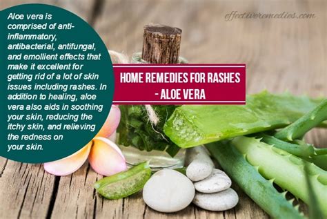 33 Natural Home Remedies For Rashes On The Body Do They Work