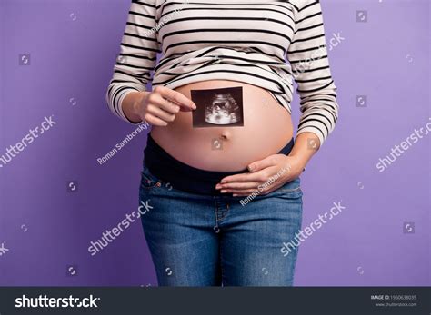 Cropped Photo Pregnant Lady Showing Xray Stock Photo 1950638035