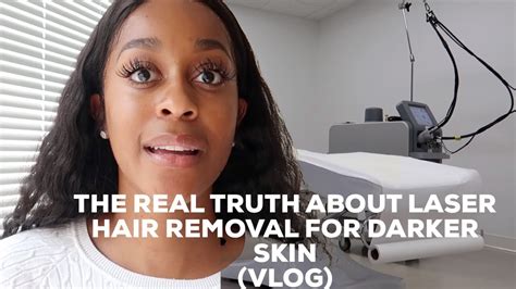 The Real Truth About Laser Hair Removal For Darker Skin Vlog Youtube