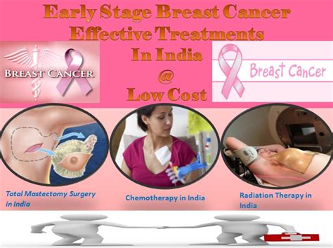 Early Stage Breast Cancer Treatment Complete Medical Assitance By