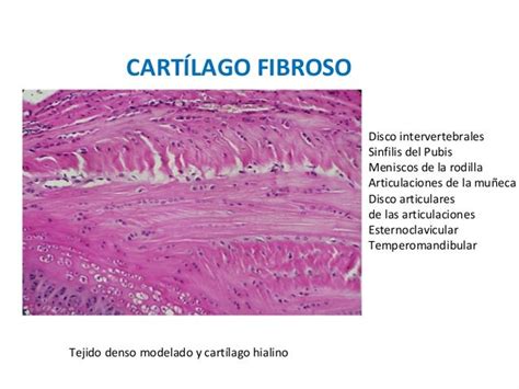 Hueso Y Cartilago