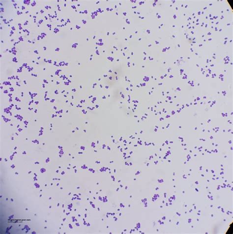 Streptococcus Pneumoniae Pneumococcus Streptococcus Pneumoniae