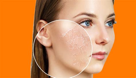 What Is Skin Turgor Understanding And Treating Poor Skin Turgor