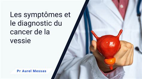 Cancer De La Vessie Sympt Mes Et Diagnostic Pr Aurel Messas