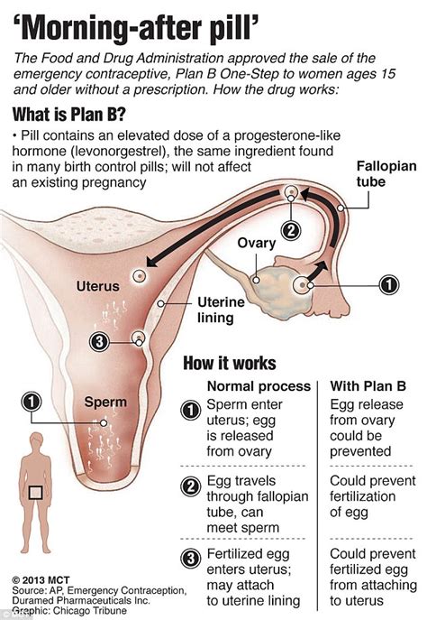 Maybe you would like to learn more about one of these? I Pill - Dosage, Price, Side Effects & Risks to Avoid Pregnancy Safely