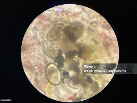 Scabies Notoedres Egg Under The Microscope Stock Photo Download Image