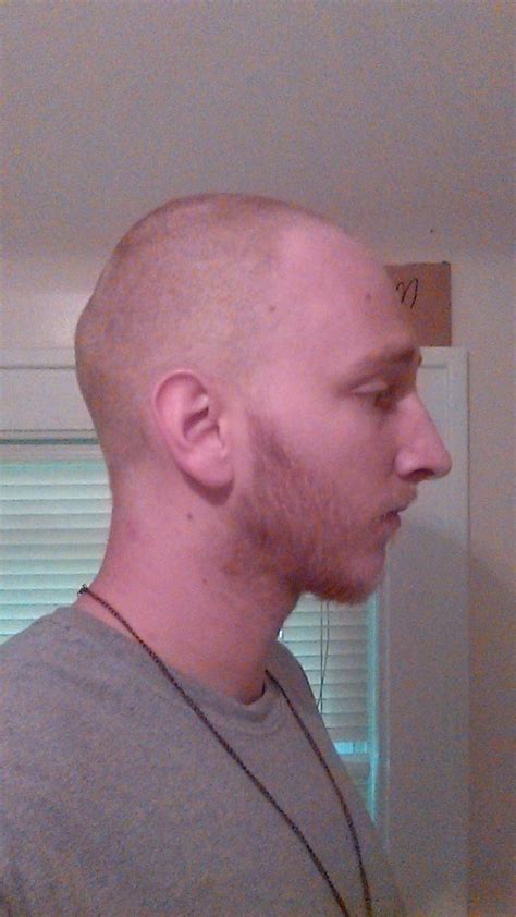 Does Anyone Else Have An Odd Head Shape I Am Bald And I Have A Weird Head So Idk Girlsaskguys