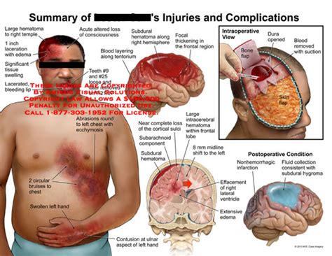 AMICUS Illustration Of Amicus Injury Summary Injuries Complications