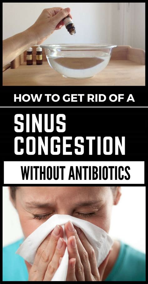 How To Get Rid Of A Sinus Congestion Without Antibiotics Sinus