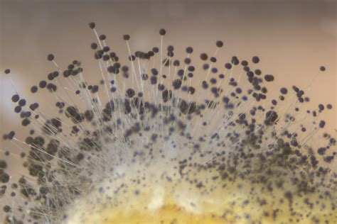 Mold Spores On Bread Rhizopus Under The Microscope Molekule Blog