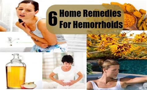 6 Natural Yet Effective Home Remedies For Hemorrhoid