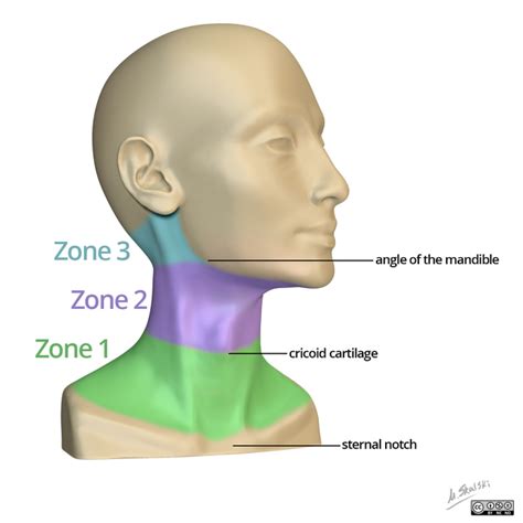 Penetrating Neck Wounds Ems Cast Podcast