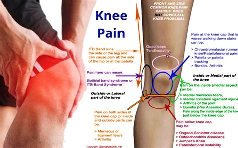 Knee Pain Homeopathic Treatment Right Knee Left Knee By Dr Makkar Artofit