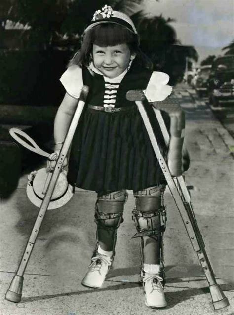 Pin By Dianne Dych On Polio 3 Leg Braces Polio Black Thigh High