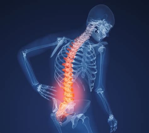 Physical Therapy Can Help Back Pain
