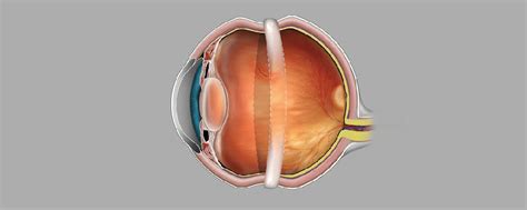 Retinal Detachment Symptoms Causes And Treatment Eyemantra