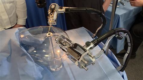 Interview Robot Transforming Eye Surgery News Uk Video News Sky News