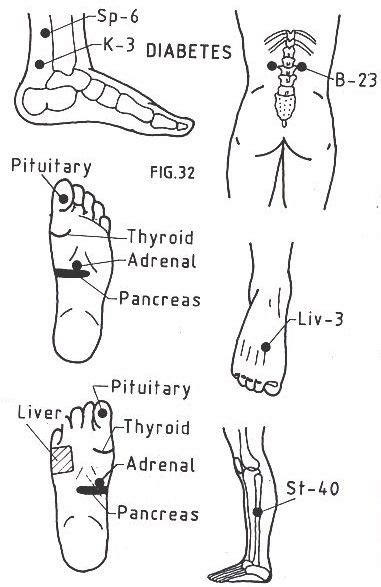 Acupressure Points To Induce Labor Chart