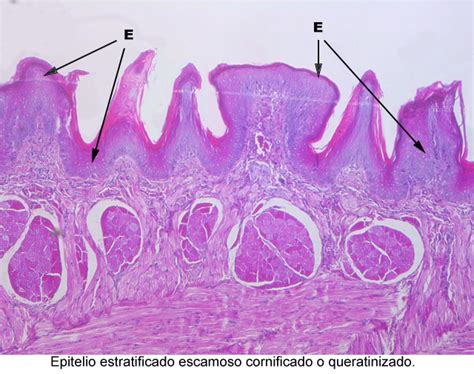 Manual Interactivo De Tejido Epitelial EPITELIO ESTRATIFICADO ESCAMOSO