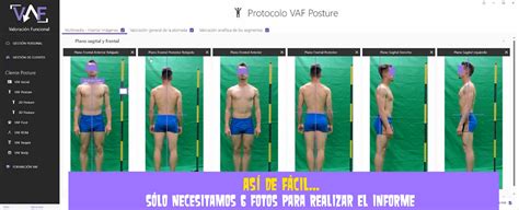 21 La Valoración Postural Protocolo Vaf Posture