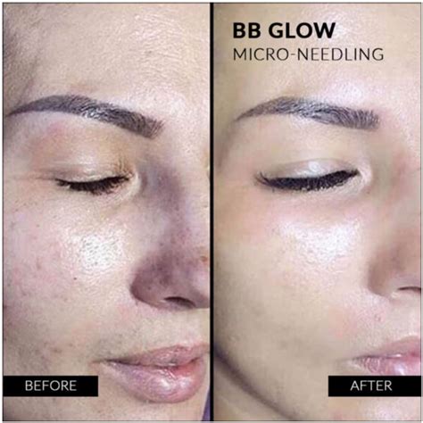 Bb Glow Facial Original Brand Prity Skincare