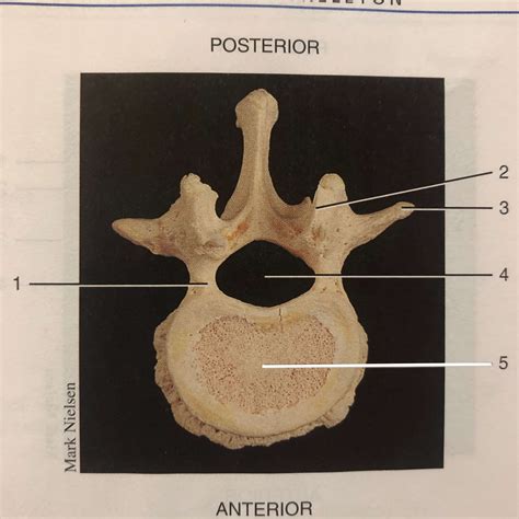 General Vertebrae Parts Flashcards | Memorang