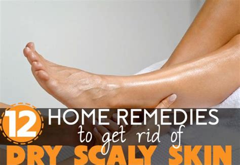 How To Get Rid Of Dry Scaly Skin On Legs 12 Home Remedies
